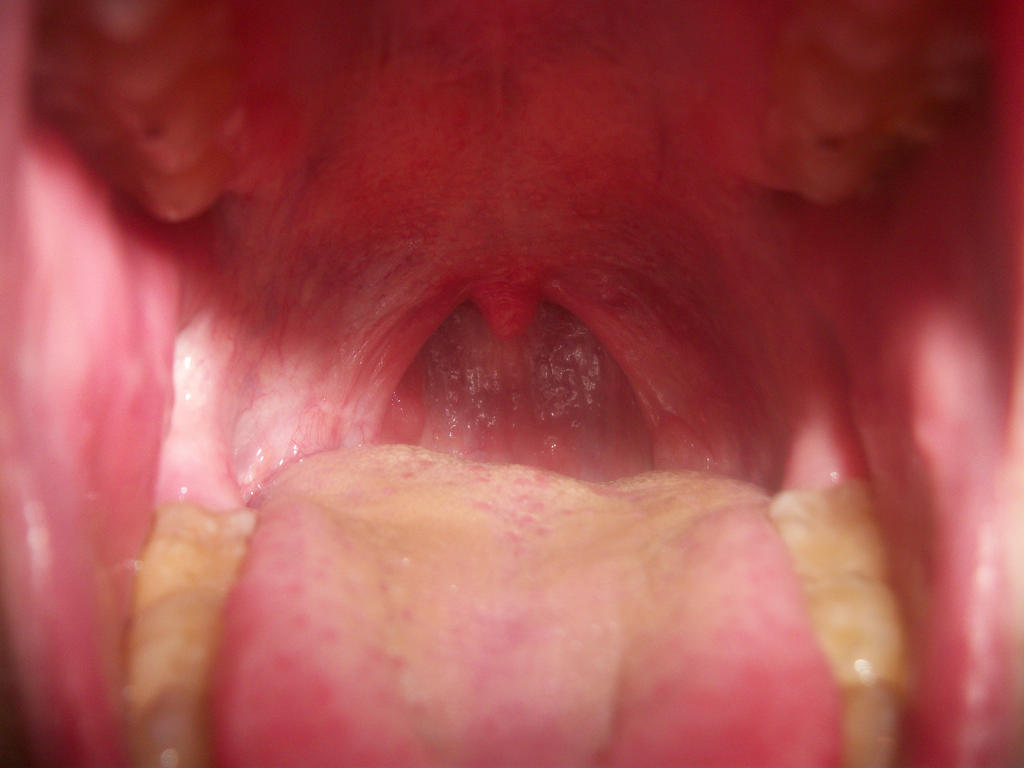 Inside Of Mouth 106